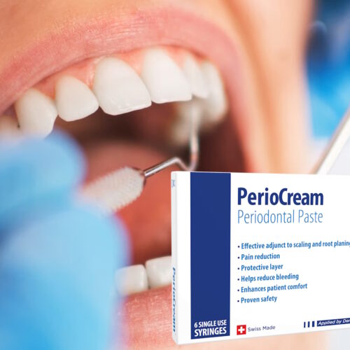 Periocream: The Future Commercial Winner for bonyf